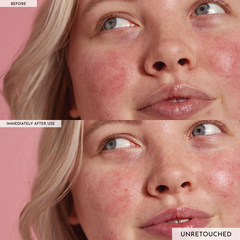 Avocado Ceramide Recovery Serum